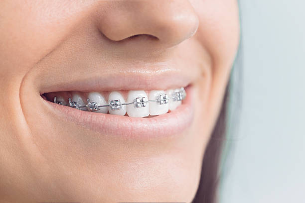 Best Dental Fillings (Composite and Amalgam)  in Wahpeton, ND